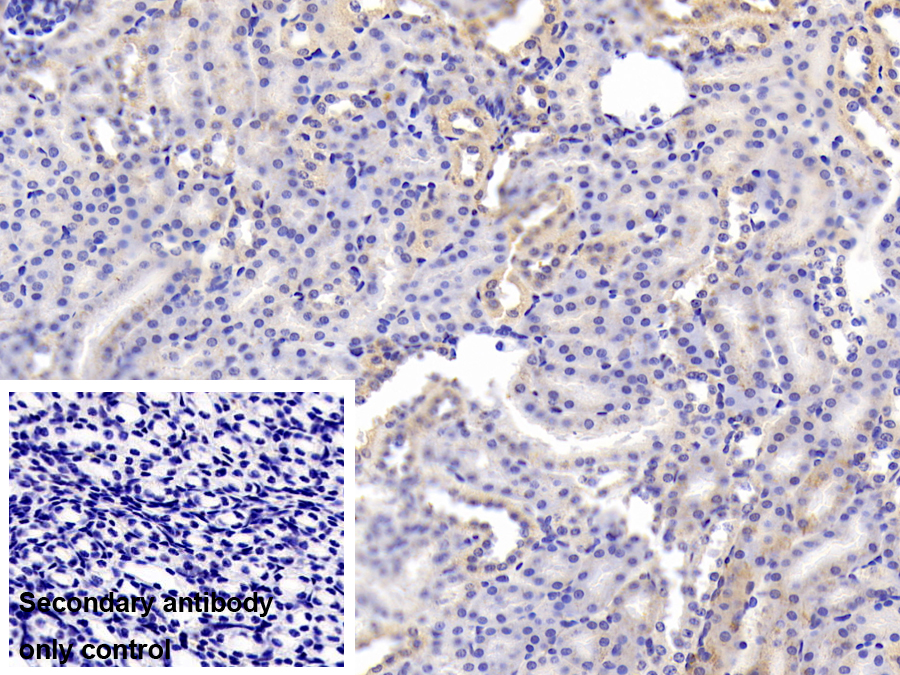 Polyclonal Antibody to Uridine Phosphorylase 1 (UPP1)