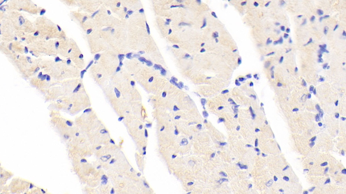 Polyclonal Antibody to Beta Secretase 2 (BACE2)