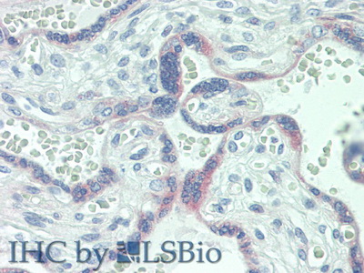 Polyclonal Antibody to Interleukin 6 Receptor (IL6R)