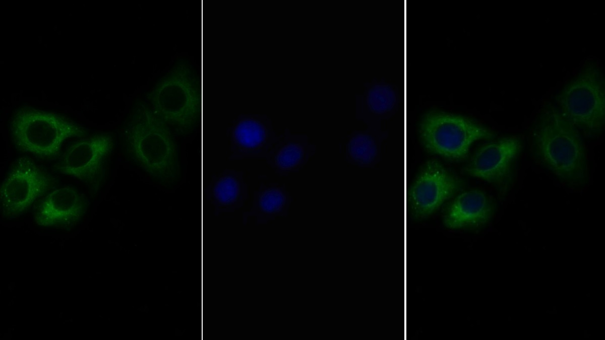 Polyclonal Antibody to Interleukin 6 Receptor (IL6R)