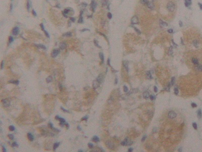 Polyclonal Antibody to Cytokeratin 17 (CK17)