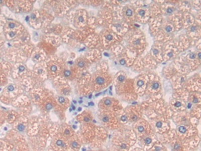 Polyclonal Antibody to Complement Component 9 (C9)