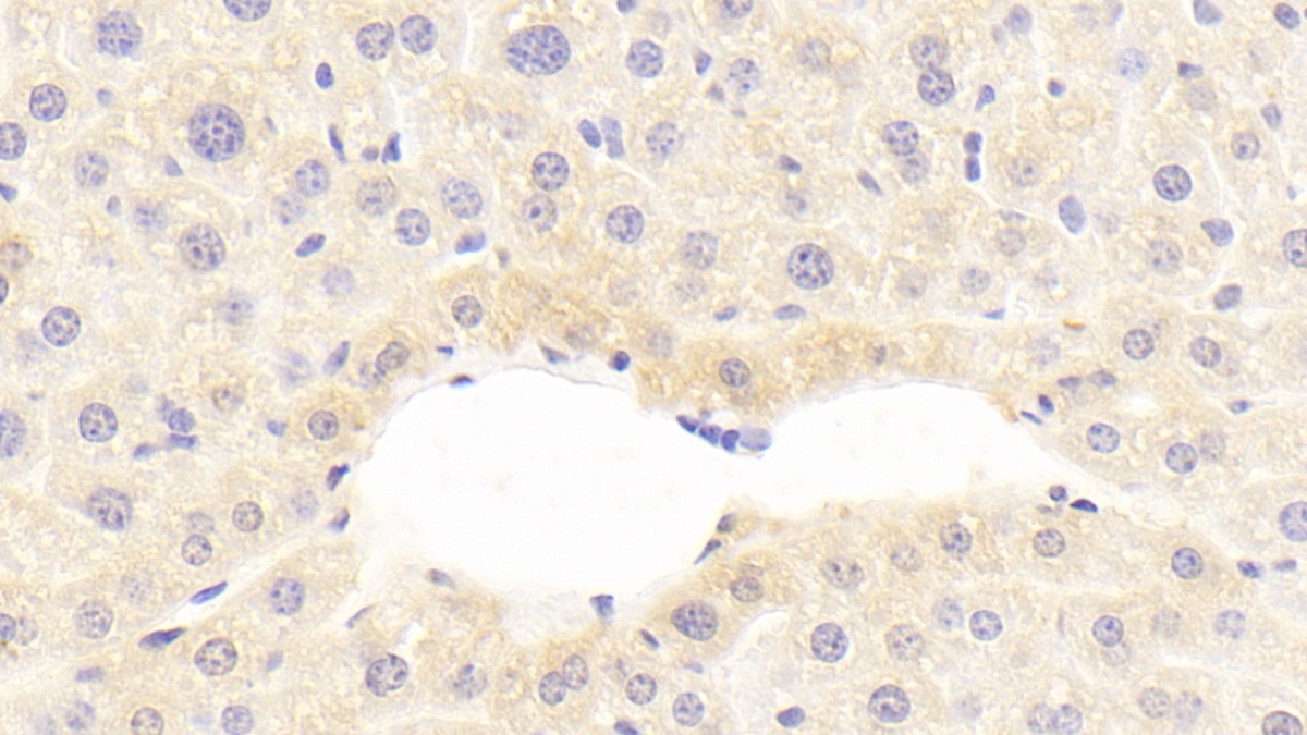 Polyclonal Antibody to Complement Component 9 (C9)