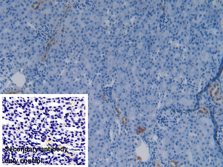 Polyclonal Antibody to Apolipoprotein C4 (APOC4)