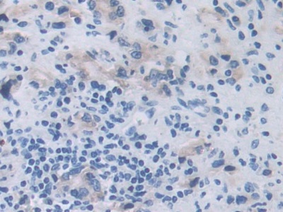 Polyclonal Antibody to A Disintegrin And Metalloprotease 9 (ADAM9)