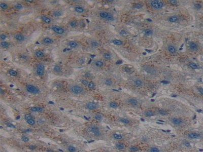 Polyclonal Antibody to Hedgehog Homolog, Sonic (SHH)