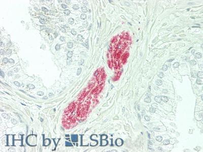 Polyclonal Antibody to Complement Factor D (CFD)