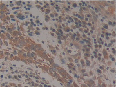 Polyclonal Antibody to Paxillin (PXN)