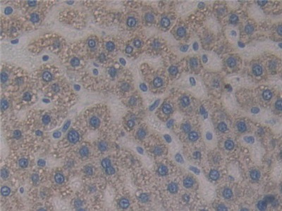 Polyclonal Antibody to Paxillin (PXN)