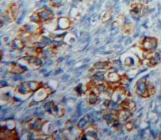 Polyclonal Antibody to Cluster Of Differentiation 83 (CD83)