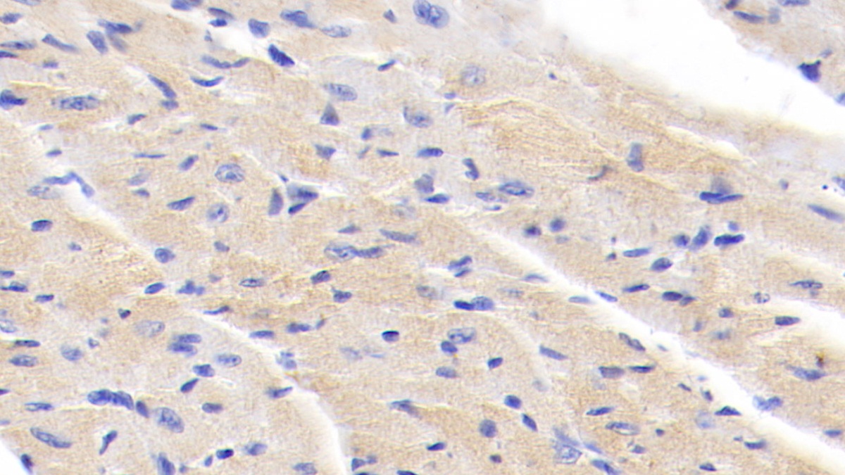 Polyclonal Antibody to Inhibitory Subunit Of NF Kappa B Beta (IkBb)