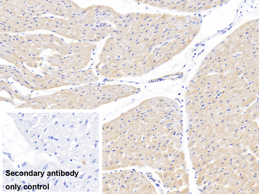 Polyclonal Antibody to Lectin Like Oxidized Low Density Lipoprotein Receptor 1 (LOX1)