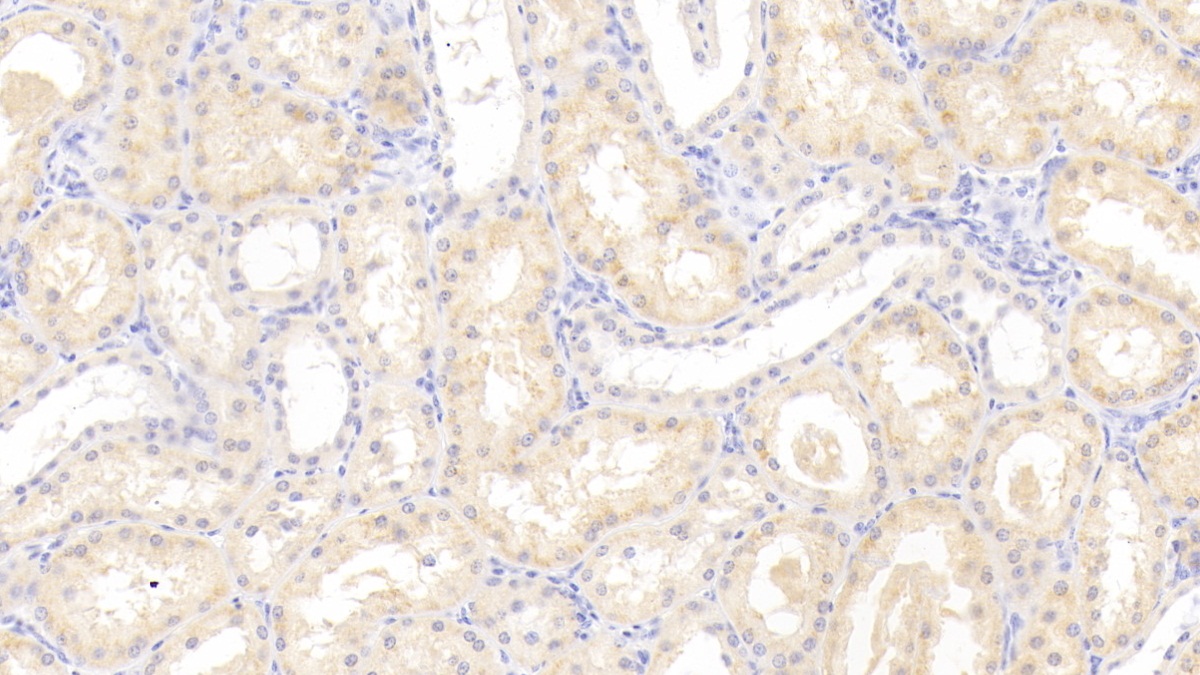 Polyclonal Antibody to Lectin Like Oxidized Low Density Lipoprotein Receptor 1 (LOX1)