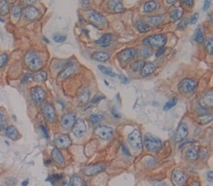 Polyclonal Antibody to Neuregulin 1 (NRG1)