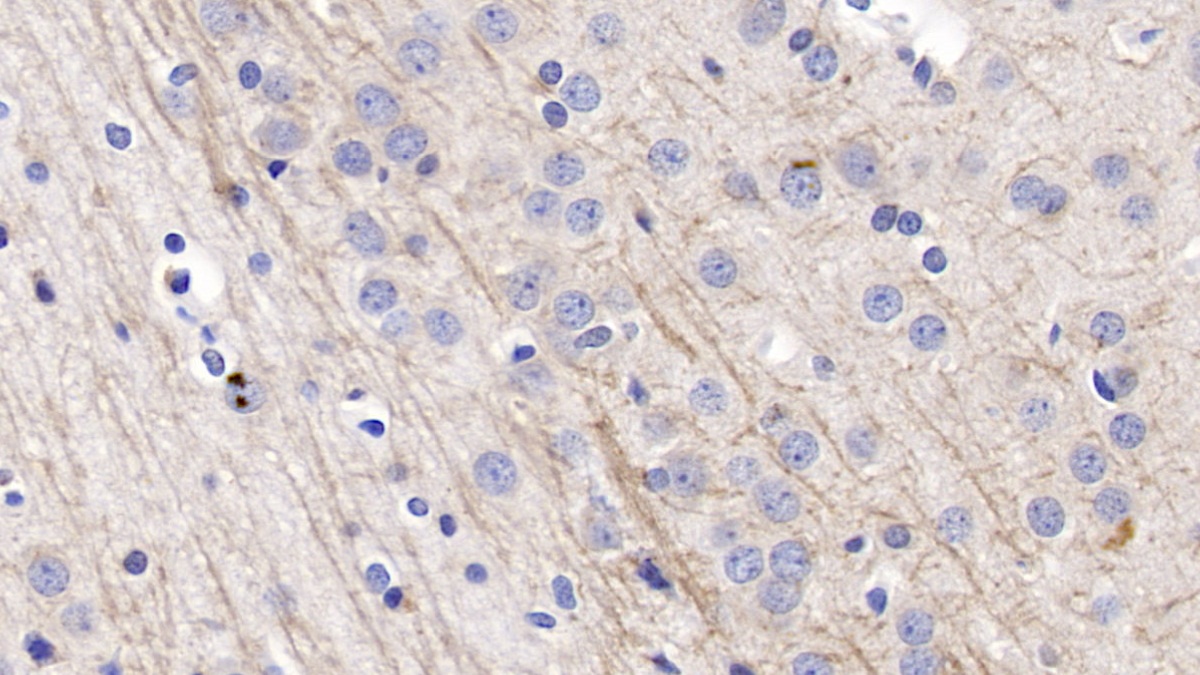 Polyclonal Antibody to Neuregulin 1 (NRG1)