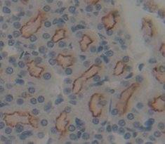 Polyclonal Antibody to Cluster Of Differentiation 19 (CD19)