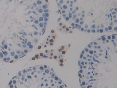 Polyclonal Antibody to High Mobility Group Nucleosome Binding Domain Protein 1 (HMGN1)