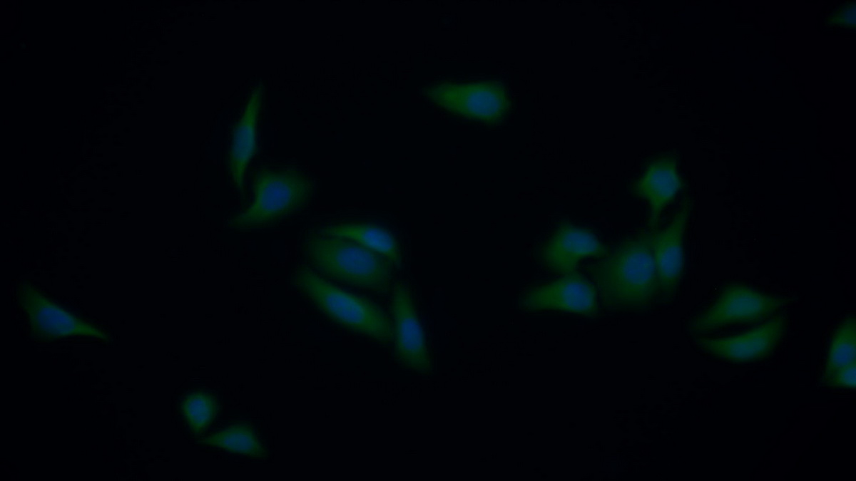 Polyclonal Antibody to Cyclin Dependent Kinase 7 (CDK7)