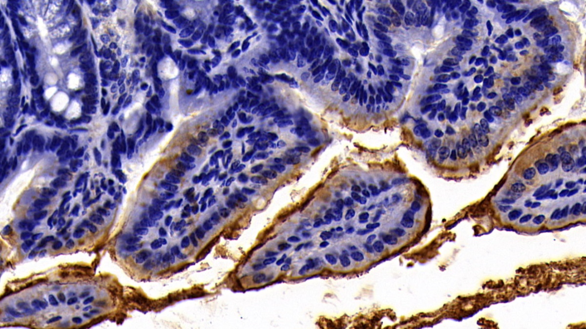 Polyclonal Antibody to Angiotensin I Converting Enzyme 2 (ACE2)