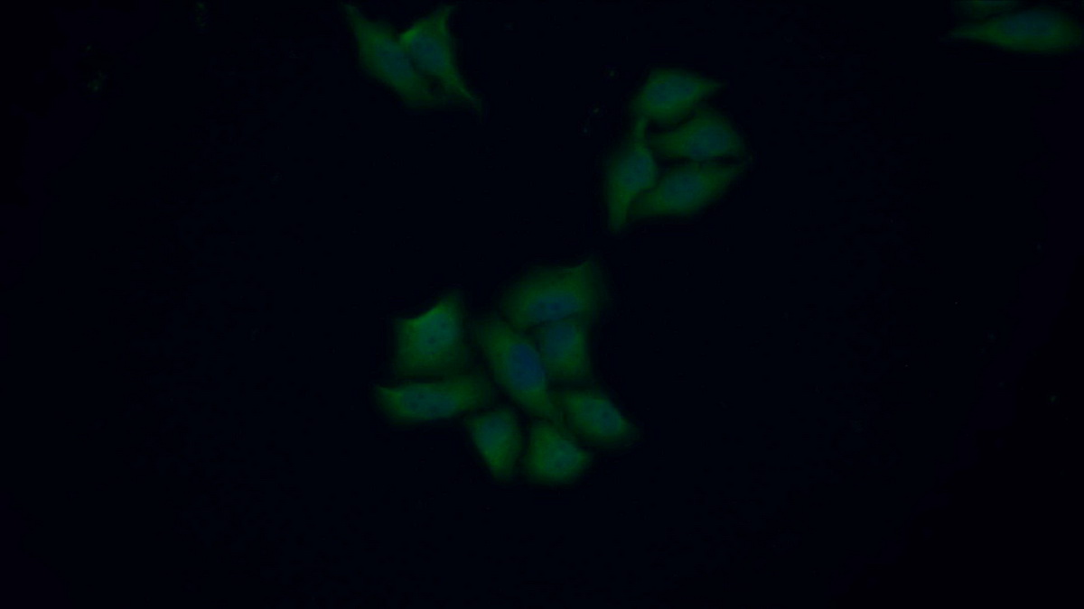 Polyclonal Antibody to Cyclin Dependent Kinase 1 (CDK1)