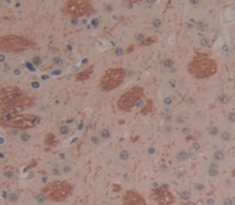 Polyclonal Antibody to Cyclin Dependent Kinase 2 (CDK2)