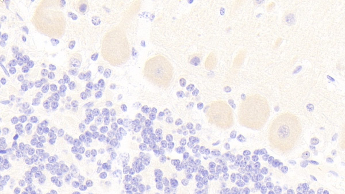 Polyclonal Antibody to Metabotropic Glutamate Receptor 3 (GRM3)