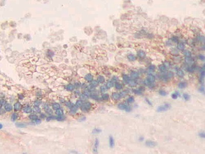 Polyclonal Antibody to Matrix Metalloproteinase 24 (MMP24)