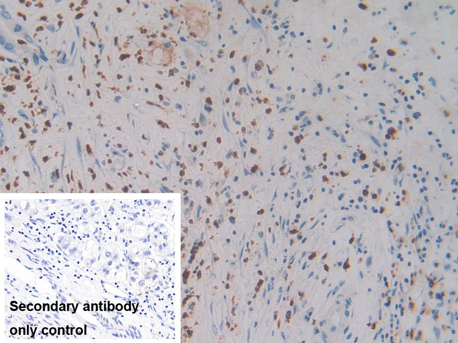 Polyclonal Antibody to Mannose Associated Serine Protease 1 (MASP1)