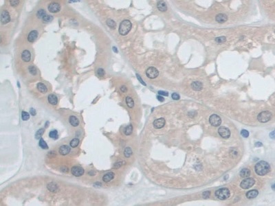 Polyclonal Antibody to Insulin Degrading Enzyme (IDE)