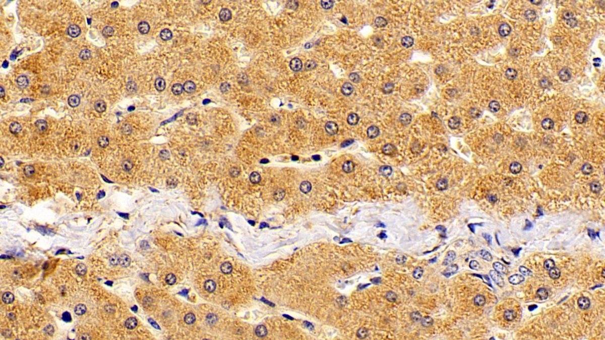 Polyclonal Antibody to Oxidosqualene Cyclase (OSC)