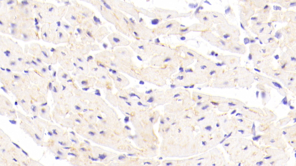 Polyclonal Antibody to Cadherin, Heart (CDHH)