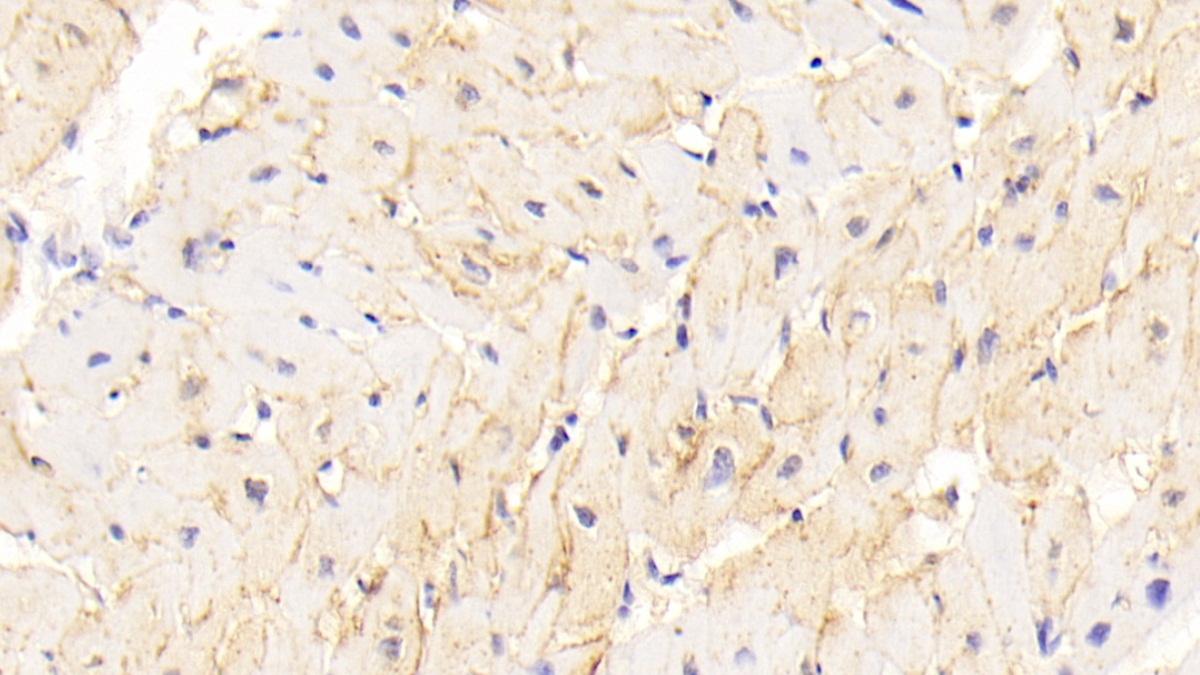 Polyclonal Antibody to Cadherin, Heart (CDHH)