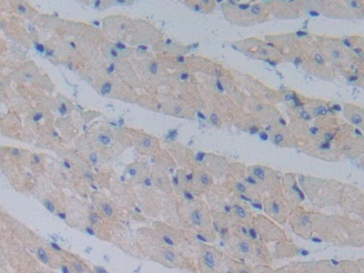 Polyclonal Antibody to Cadherin, Heart (CDHH)