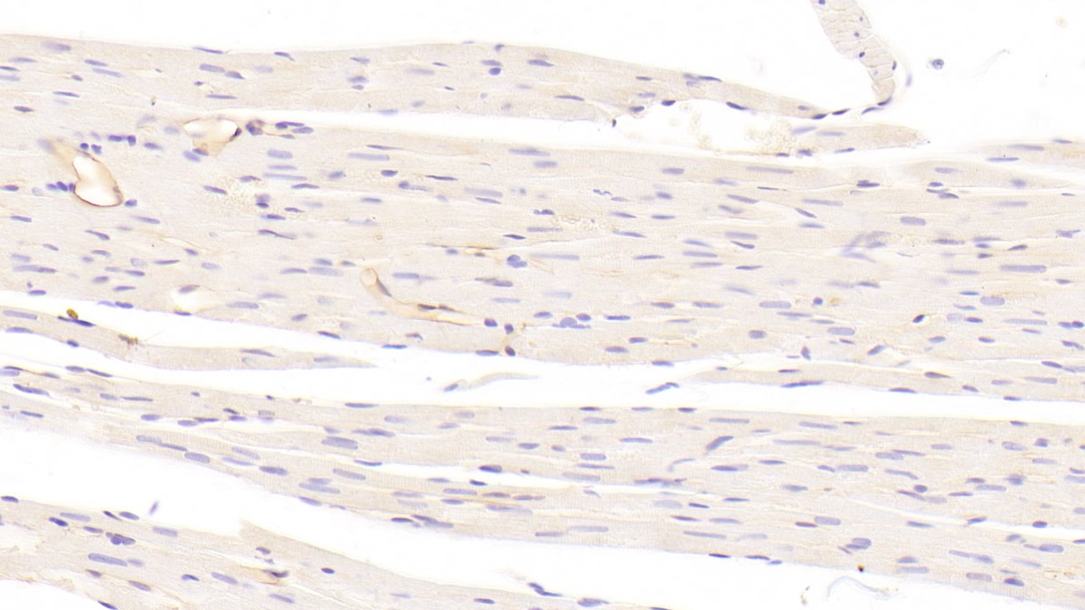 Polyclonal Antibody to Cadherin, Heart (CDHH)