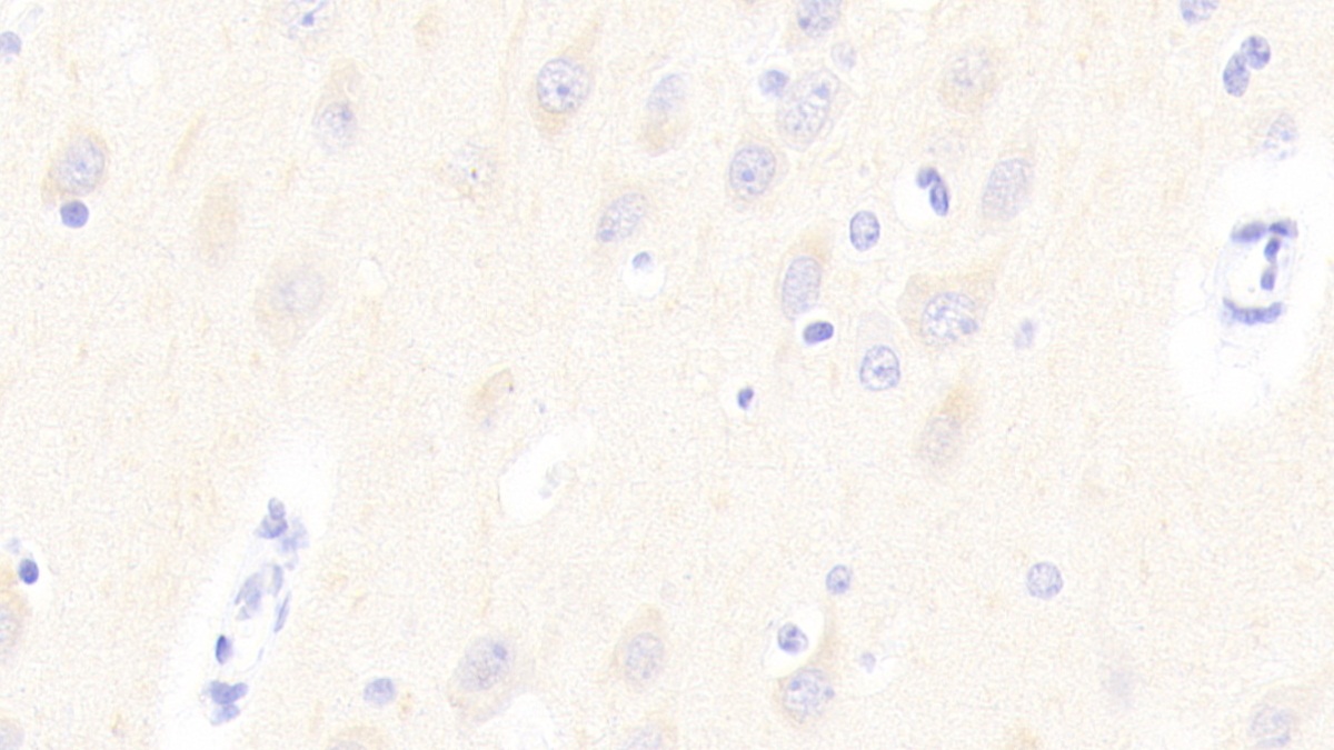 Polyclonal Antibody to Glycoprotein VI (GP6)