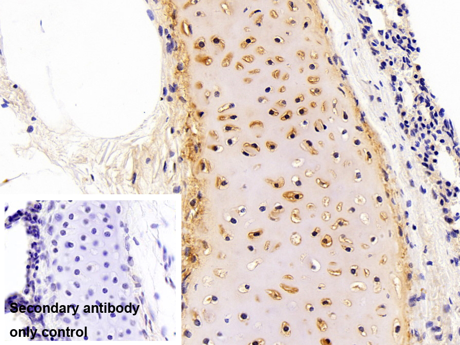 Polyclonal Antibody to Aggrecan (AGC)