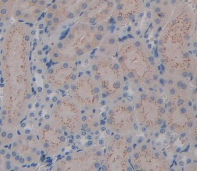 Polyclonal Antibody to Kallikrein 7 (KLK7)