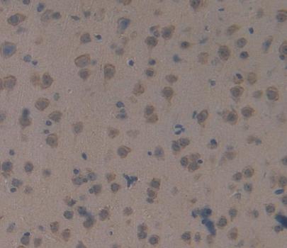 Polyclonal Antibody to S Antigen (SAG)