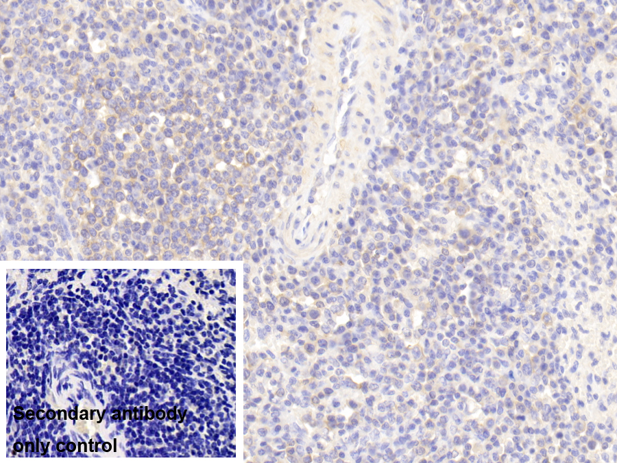 Polyclonal Antibody to Wiskott Aldrich Syndrome Protein (WASP)