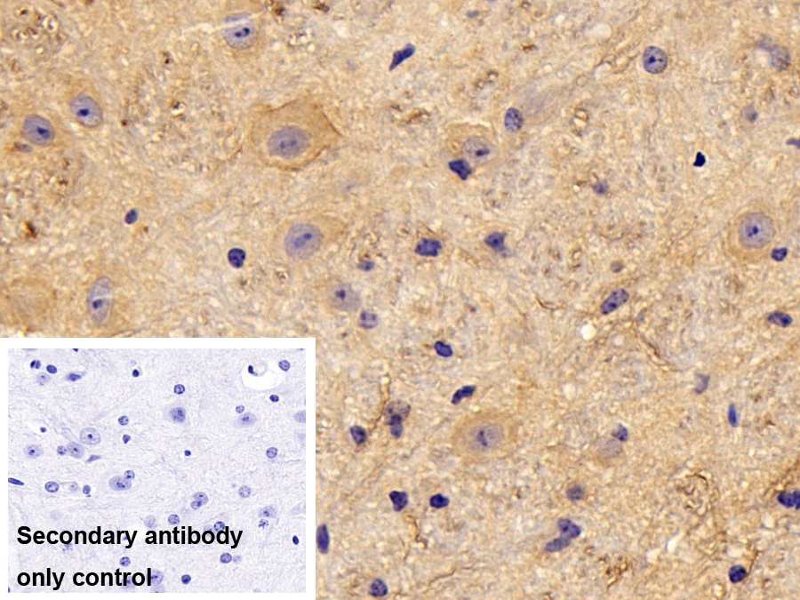 Polyclonal Antibody to Protein Kinase C Alpha (PKCa)