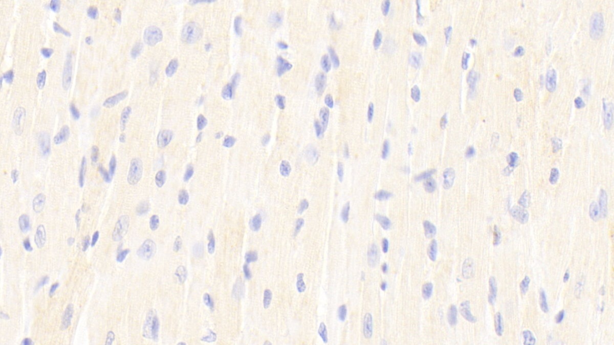 Polyclonal Antibody to Pyruvate Dehydrogenase Beta (PDHb)