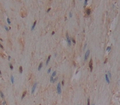 Polyclonal Antibody to Mothers Against Decapentaplegic Homolog 4 (Smad4)