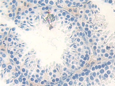 Polyclonal Antibody to Mothers Against Decapentaplegic Homolog 4 (Smad4)