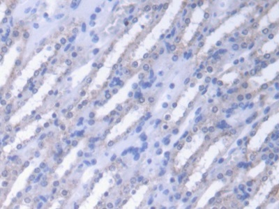 Polyclonal Antibody to Fumarase (FUM)