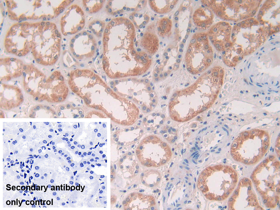 Polyclonal Antibody to Cathepsin S (CTSS)