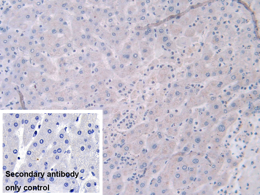 Polyclonal Antibody to Tenascin X (TNX)