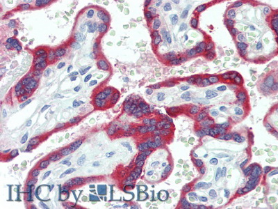 Polyclonal Antibody to Tissue Factor Pathway Inhibitor 2 (TFPI2)