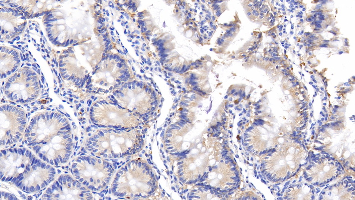 Polyclonal Antibody to Immunoglobulin D (IgD)