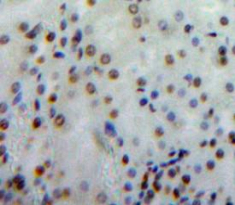 Polyclonal Antibody to Neurofibromin 2 (NF2)