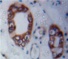 Polyclonal Antibody to Neurofibromin 2 (NF2)